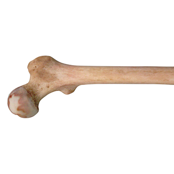 Femur prox whole and distal without st