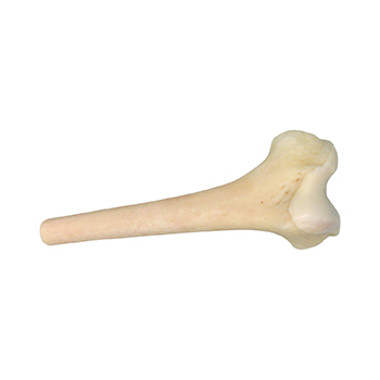 Femur prox whole and distal without ST