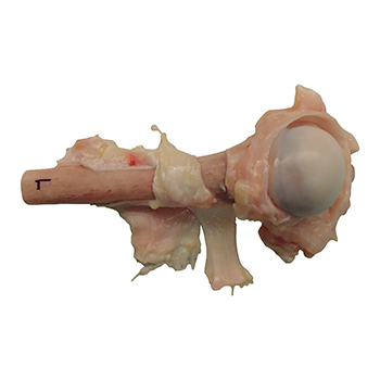 Humerus prox