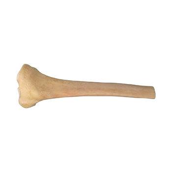 Tibia prox whole and distal without ST-2