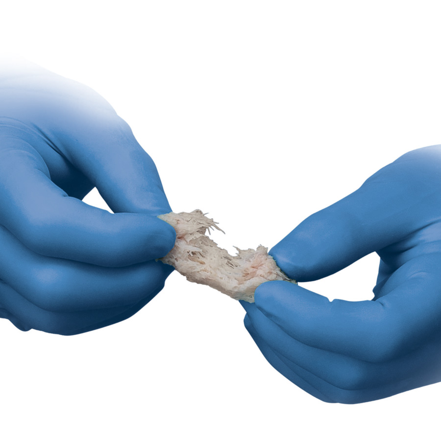 Trinity ELITE® Allograft with Viable Cells