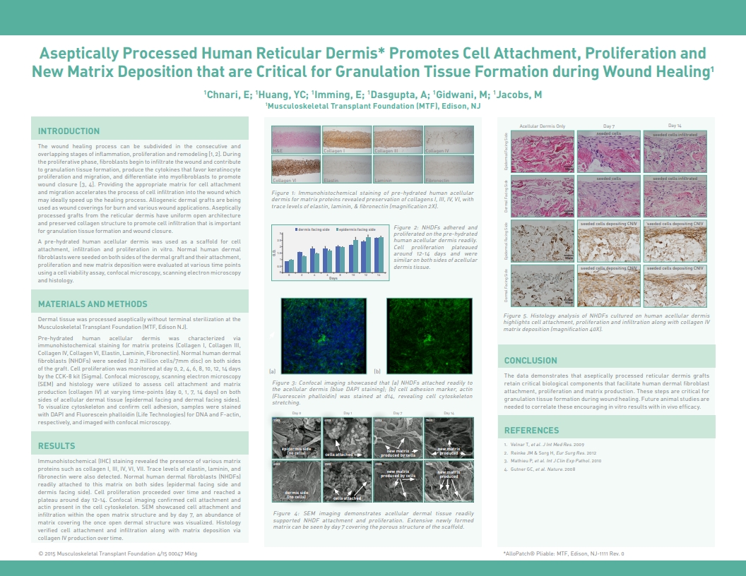 Chnari E, Huang YC, Imming E, Jacobs M. A Novel Design of Aseptically Processed Human Reticular Dermis Promotes Enhanced Cell Attachment, Proliferation and New Matrix Deposition in Wound Healing. SAWC 2015 Spring. San Antonio, TX, USA