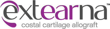 Extearna™ Costal Cartilage Allograft