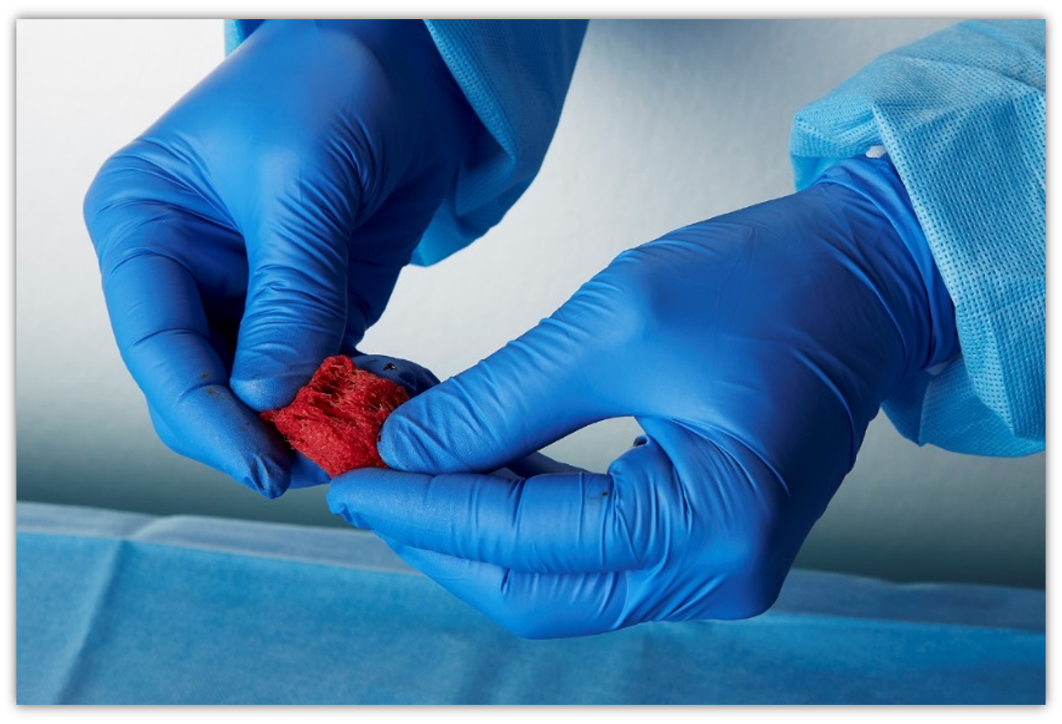 ifactor bone graft ifactor bone graft