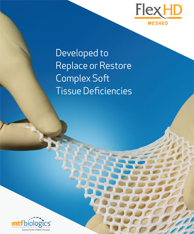 FlexHD Meshed Brochure