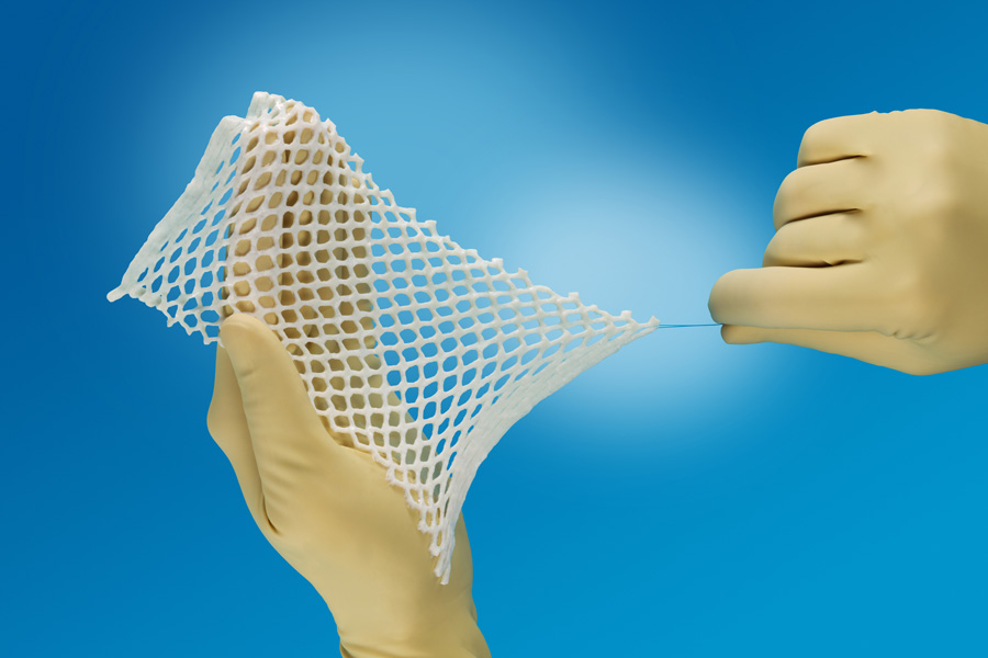 SomaGen® Meshed, Allograft Dermal Matrix