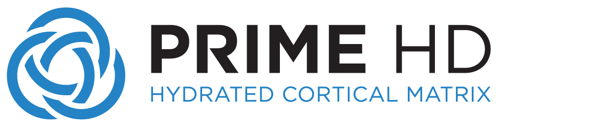 Prime HD