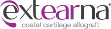 Extearna&#174; Costal Cartilage Allograft