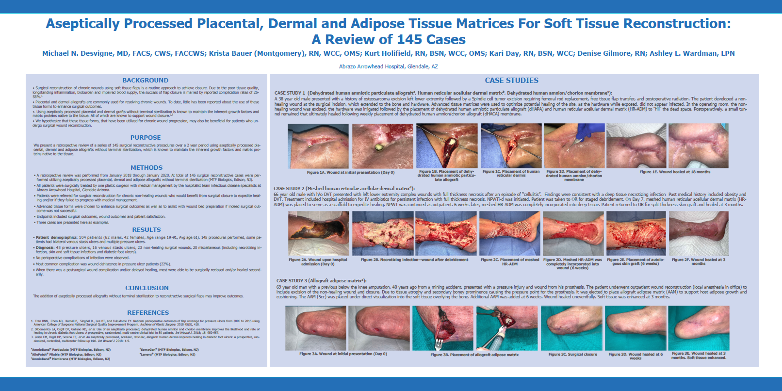 Desvigne M., Bauer K., Holifield K., Day K., Gilmore D., Wardman A. Aseptically Processed Placental, Dermal and Adipose Tissue Matrices For Soft Tissue Reconstruction: A Review of 145 Cases. SAWC 2020 Fall.